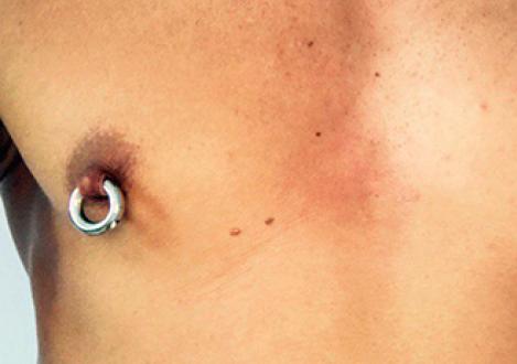 Nipple piercing in girls: care, reviews